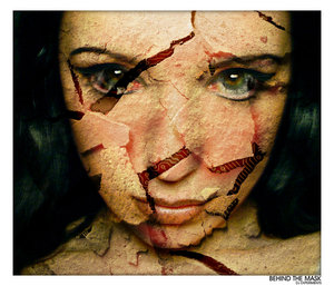 piti acciden pour kelke poin de suture